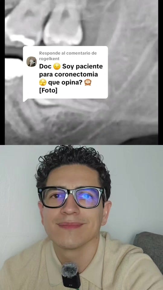 Post 5 by Dr miel 🍯 | 🦷 Dentista on TikTok (video)