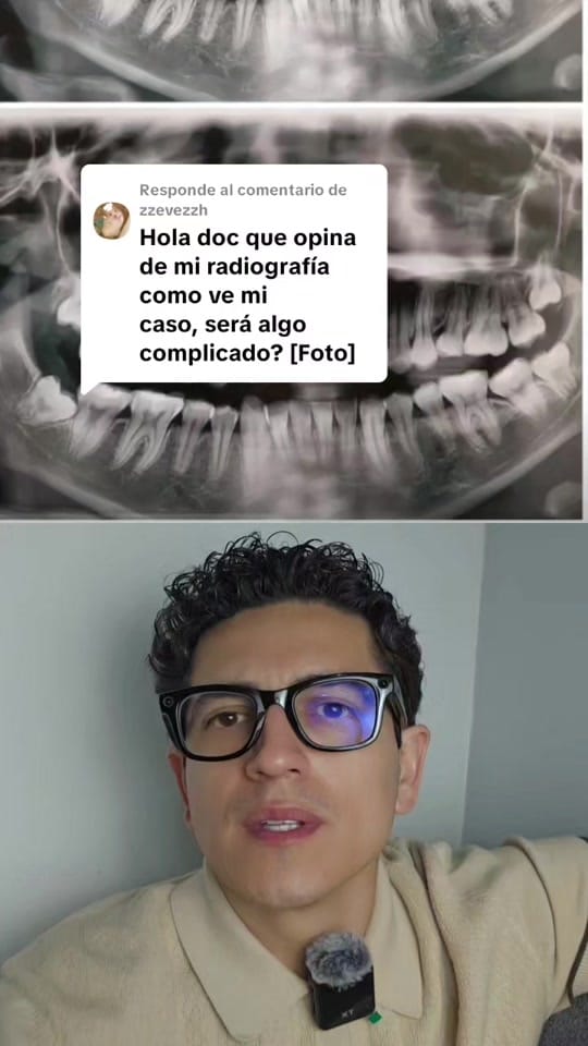 Post 2 by Dr miel 🍯 | 🦷 Dentista on TikTok (video)