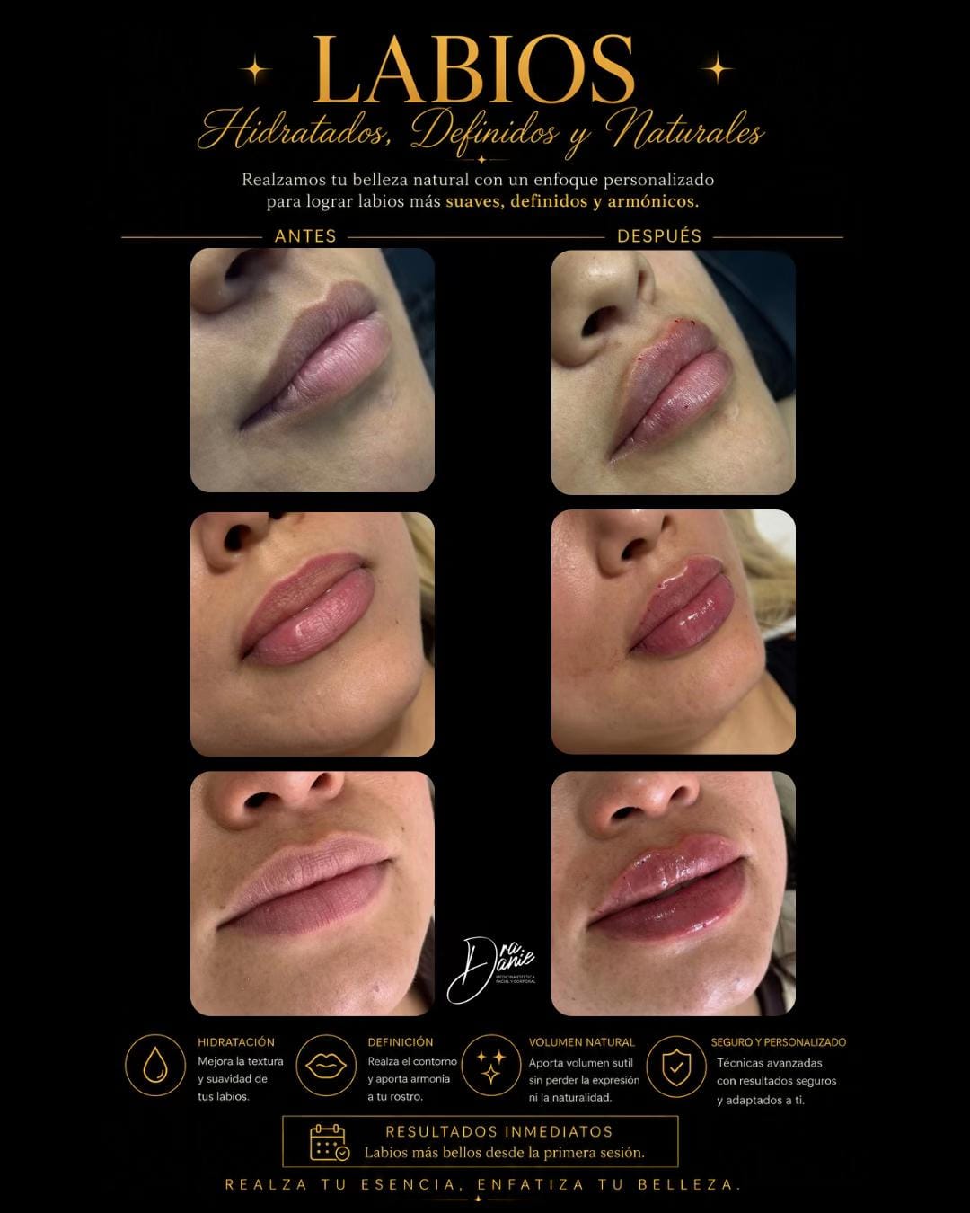 Post 6 by Dra Danie 💉 👄 on TikTok (video)