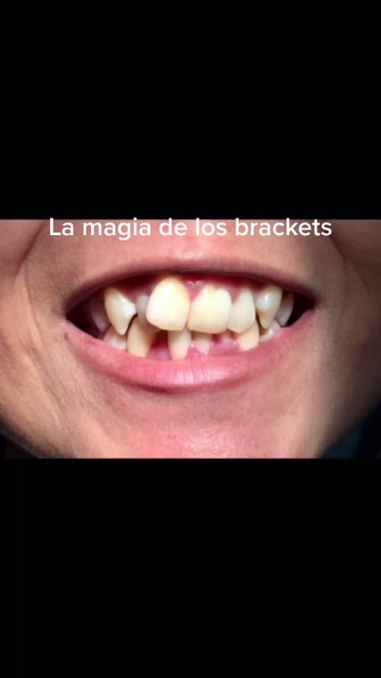 Post 8 by Dra Eli Álvarez on TikTok (video)