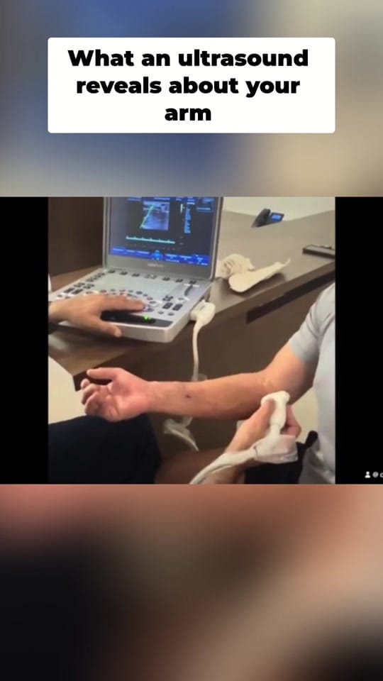 Post 3 by dr.gprado on TikTok (video)