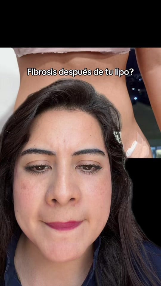 Post 3 by michcastilleros on TikTok (video)