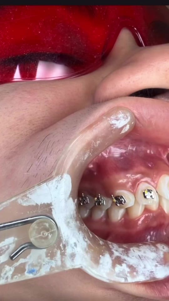 Post 1 by Dra.IngridCastillodentista on TikTok (video)