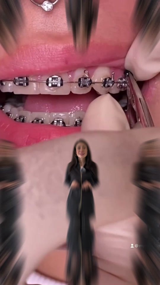 Post 8 by Los Dentistas de TikTok 🦷🔥 on TikTok (video)