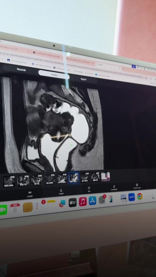 Post 10 by Ram Cabrera MD Msc on TikTok (video)