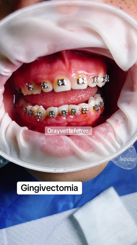 Post 3 by Dra Yvette Ferrer on TikTok (video)