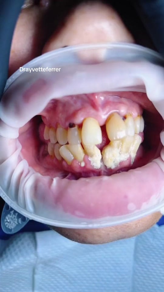 Post 1 by Dra Yvette Ferrer on TikTok (video)