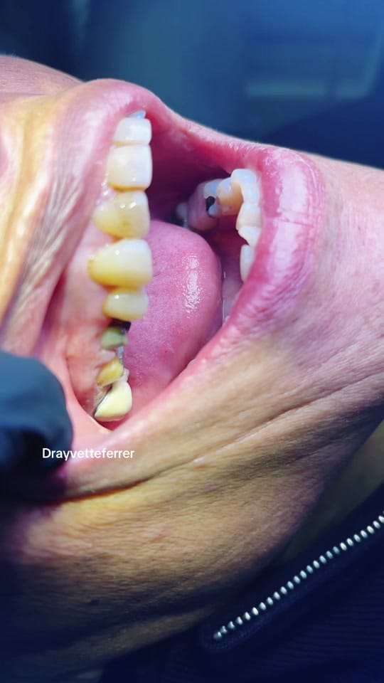 Post 6 by Dra Yvette Ferrer on TikTok (video)