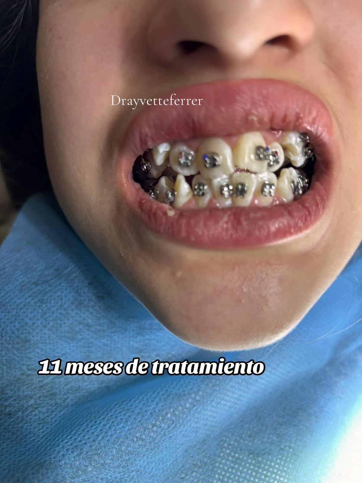 Post 4 by Dra Yvette Ferrer on TikTok (video)