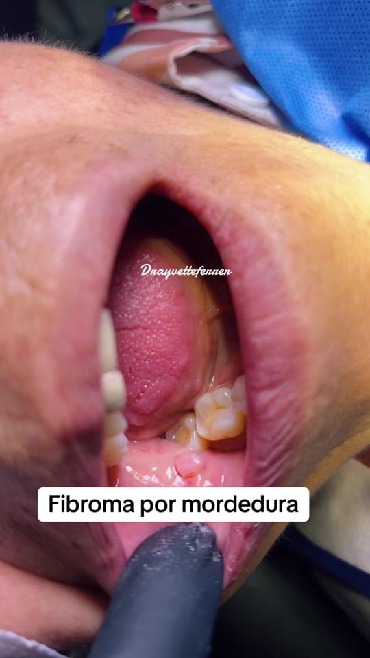 Post 9 by Dra Yvette Ferrer on TikTok (video)