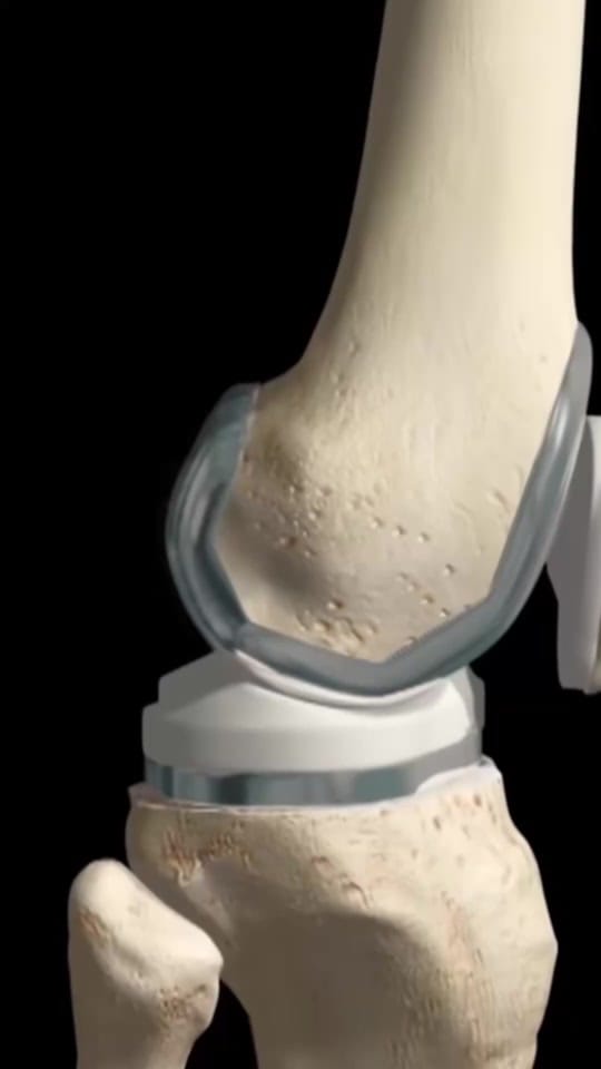 Post 3 by Dr. Mario López ortopedista on TikTok (video)