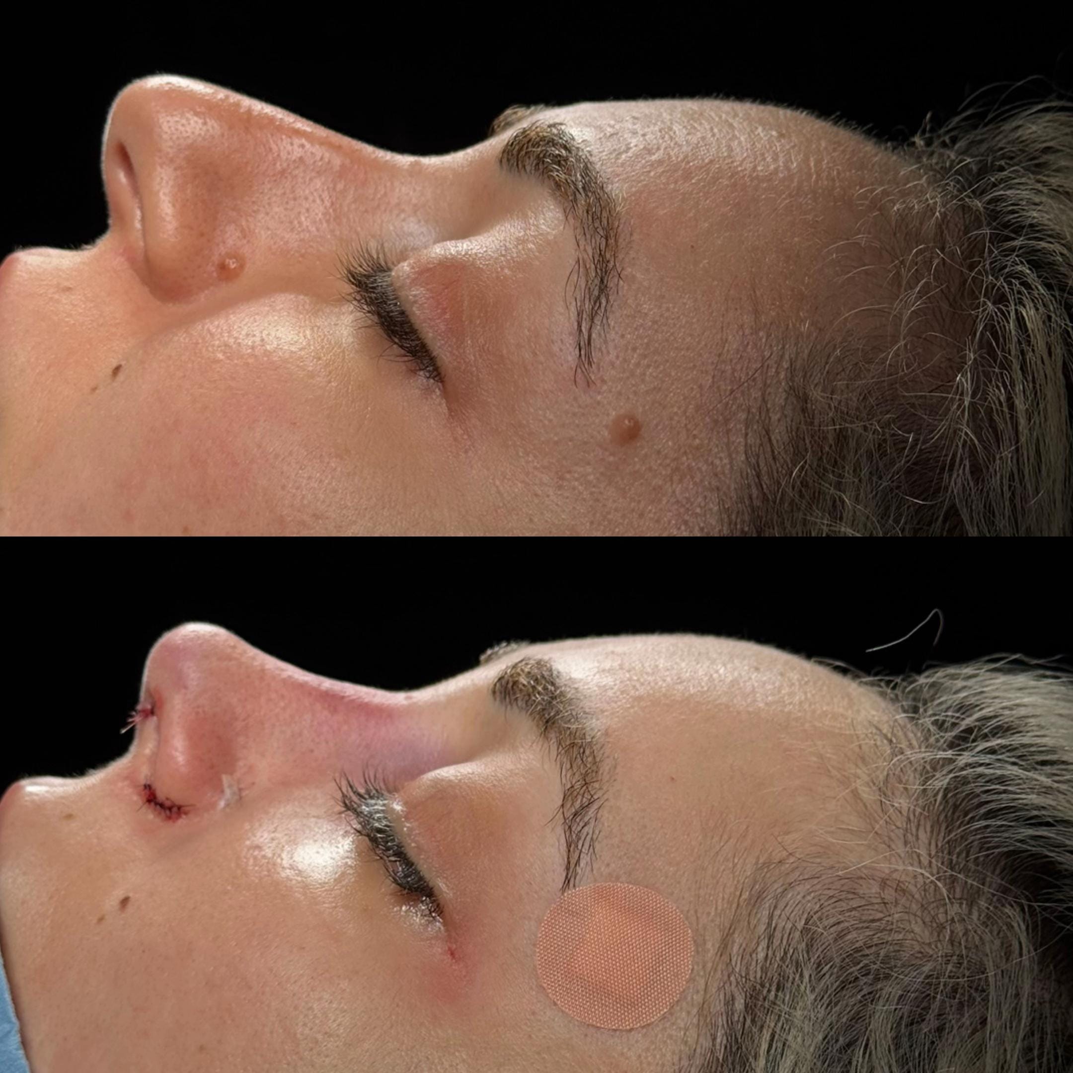 Post 4 by Dr. Angel Castro Rinoplastia on TikTok (video)