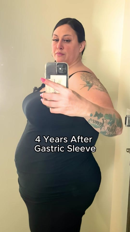 Post 8 by Mexico Bariatric Center on TikTok (video)