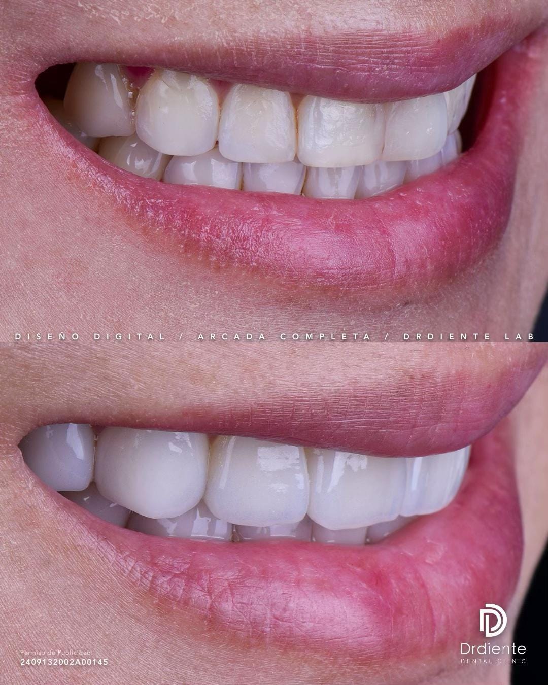Post 7 by Dentista CDMX Clínica Drdiente on TikTok (video)