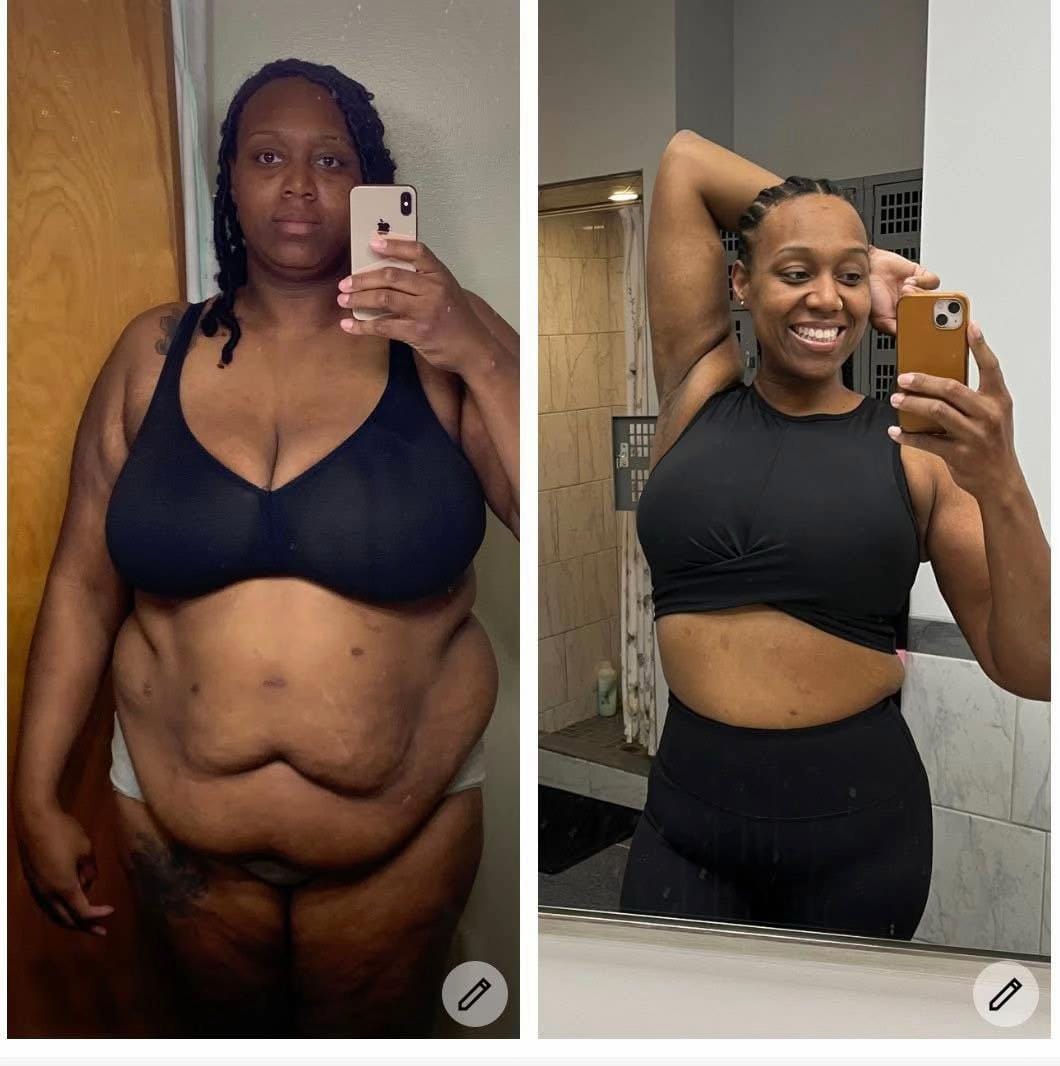 Post 5 by CervantesBariatrics on TikTok (video)