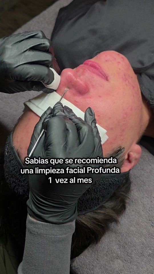 Post 3 by BSMEDICALSPA on TikTok (video)