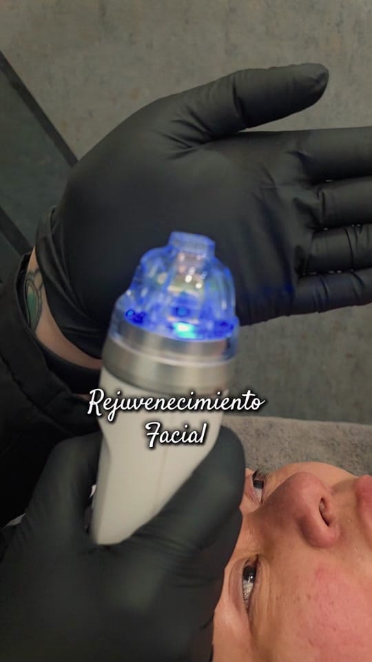 Post 9 by BSMEDICALSPA on TikTok (video)
