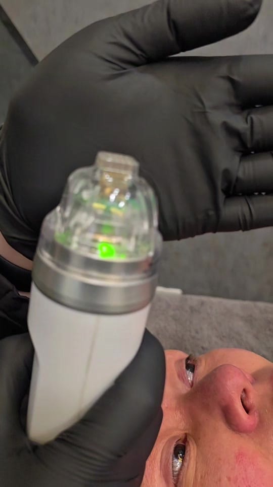 Post 2 by BSMEDICALSPA on TikTok (video)