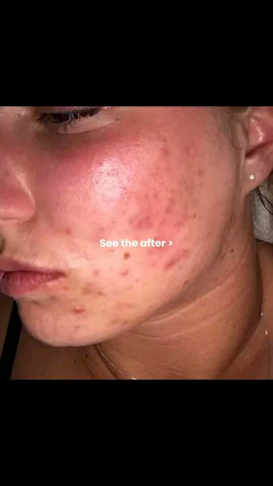 Post 3 by Clay And Glow on TikTok (video)