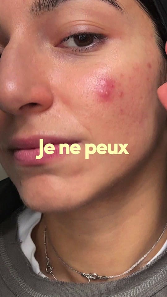 Post 4 by SKINOREA • skincare coréenne on TikTok (video)