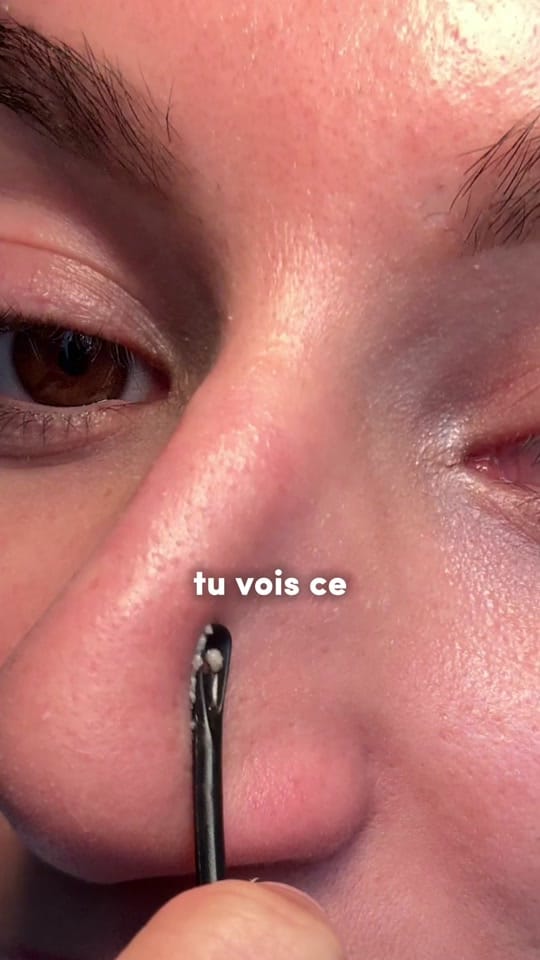Post 7 by SKINOREA • skincare coréenne on TikTok (video)