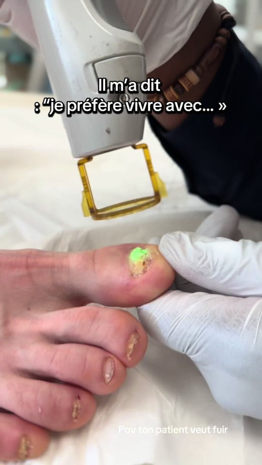 Post 8 by MycoseKiller on TikTok (video)