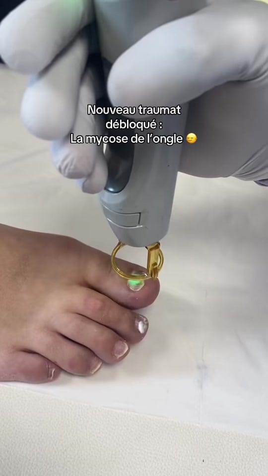 Post 9 by MycoseKiller on TikTok (video)