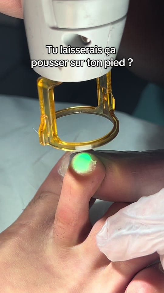 Post 4 by MycoseKiller on TikTok (video)