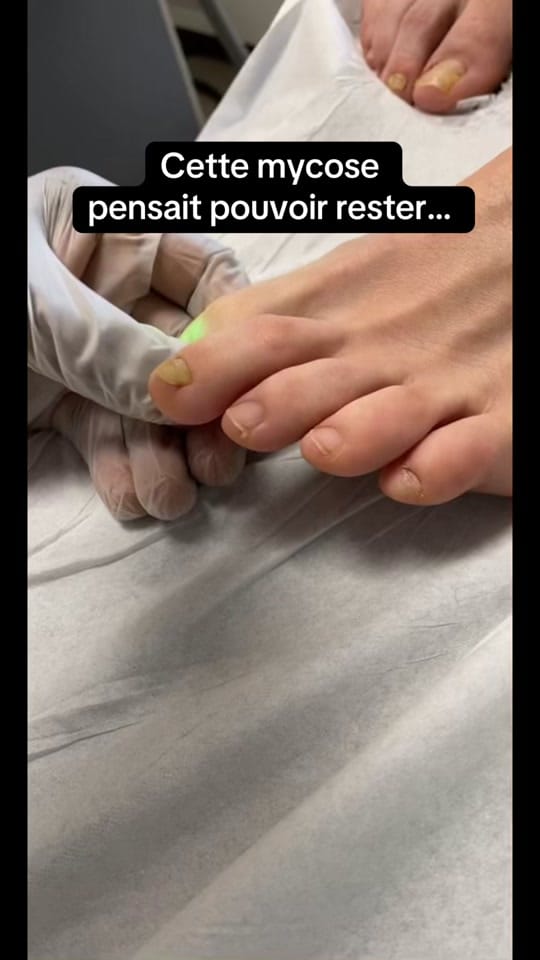 Post 7 by MycoseKiller on TikTok (video)