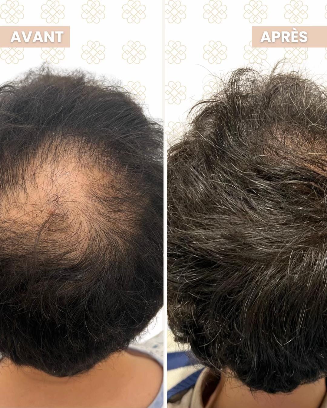Post 3 by Dr.Boclet 💉 on TikTok (video)
