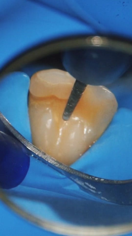 Post 2 by Dr.Sun🦷☀️ on TikTok (video)
