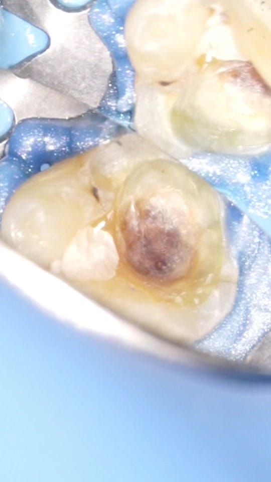 Post 5 by Dr.Sun🦷☀️ on TikTok (video)