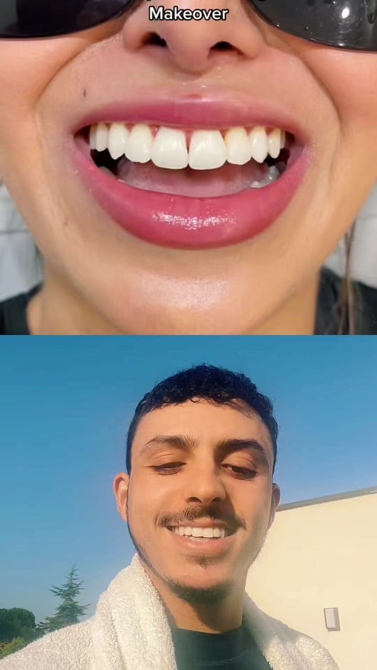 Post 3 by Dr.Sun🦷☀️ on TikTok (video)