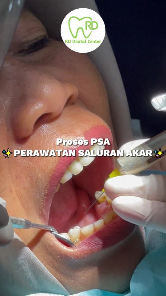 Post 9 by RD Dental Center on TikTok (video)