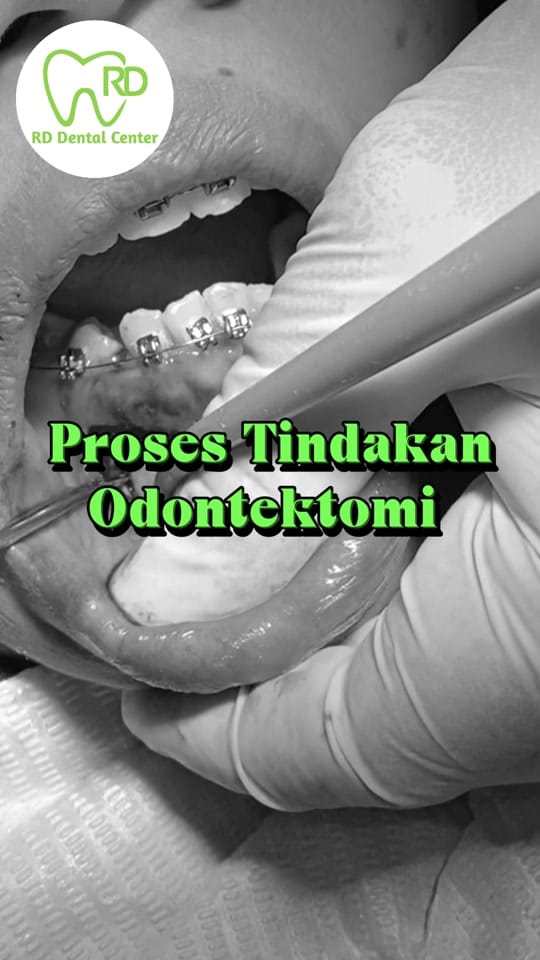 Post 8 by RD Dental Center on TikTok (video)