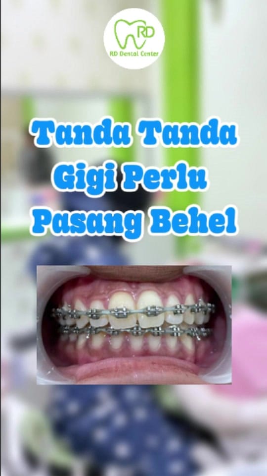Post 6 by RD Dental Center on TikTok (video)