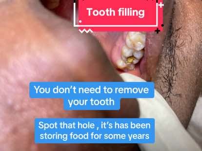 Post 10 by TEETH WHITENING PRO IN SANGO on TikTok (video)
