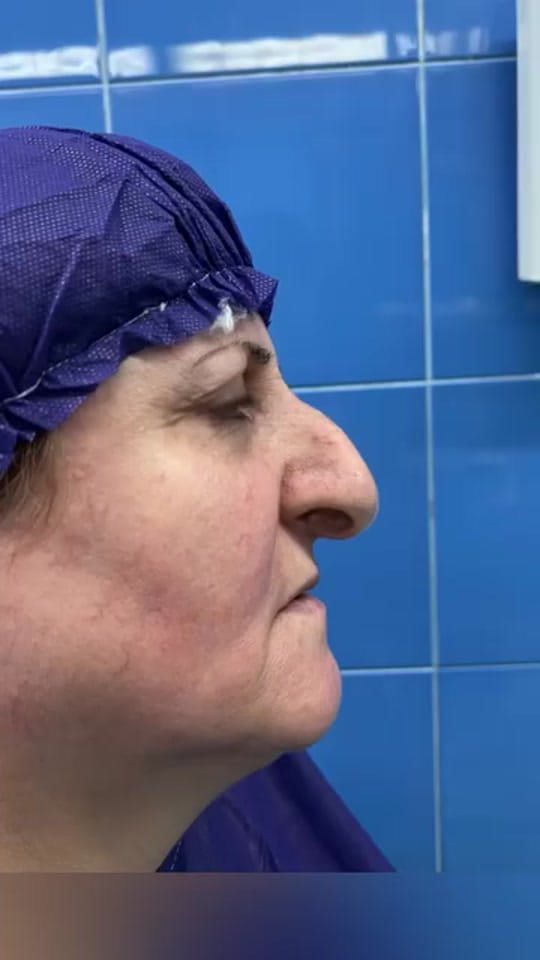 Post 2 by turkeybeautyplastic on TikTok (video)