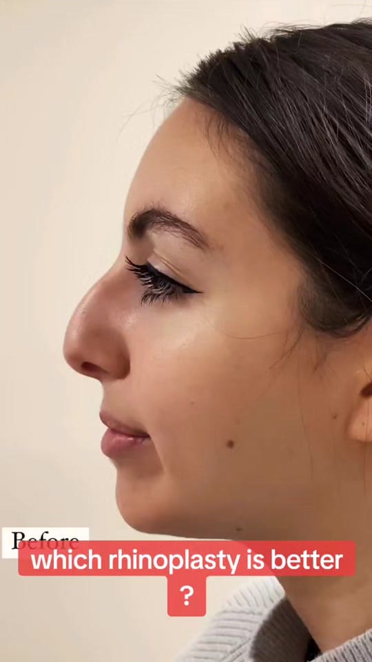 Post 10 by turkeybeautyplastic on TikTok (video)