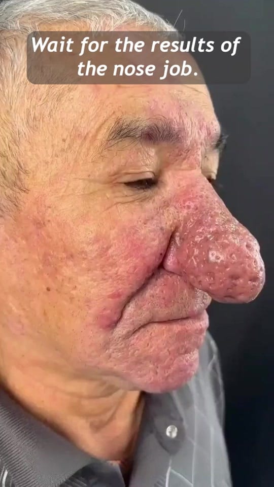 Post 8 by turkeybeautyplastic on TikTok (video)