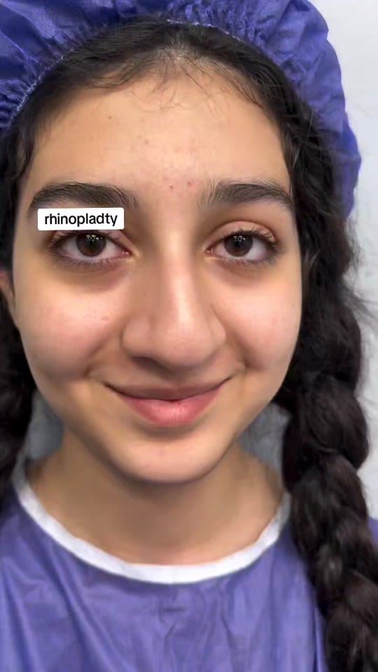 Post 5 by turkeybeautyplastic on TikTok (video)
