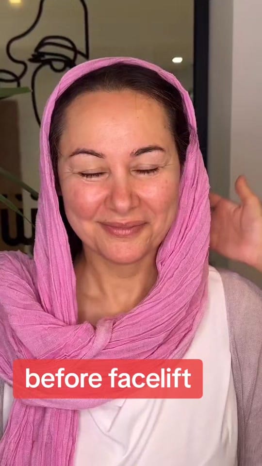 Post 4 by turkeybeautyplastic on TikTok (video)
