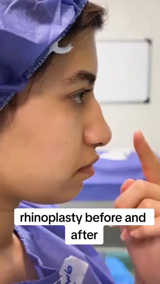 Post 1 by turkeybeautyplastic on TikTok (video)