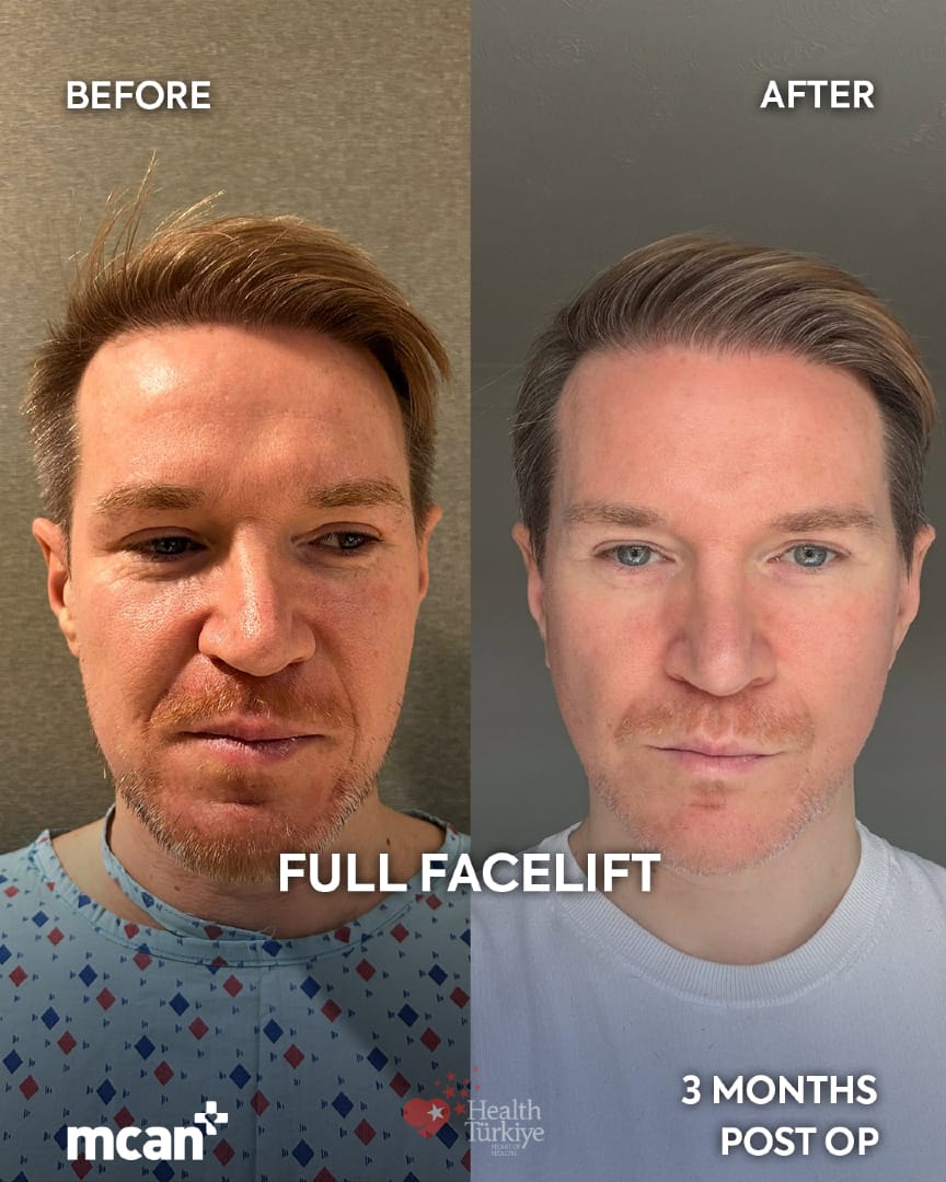 Post 8 by MCANHEALTH on TikTok (video)