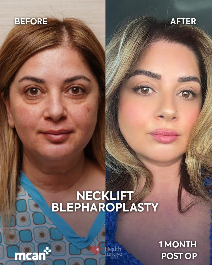 Post 5 by MCANHEALTH on TikTok (video)