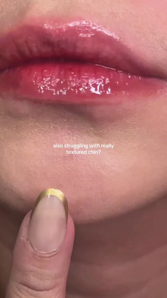 Post 10 by mika on TikTok (video)