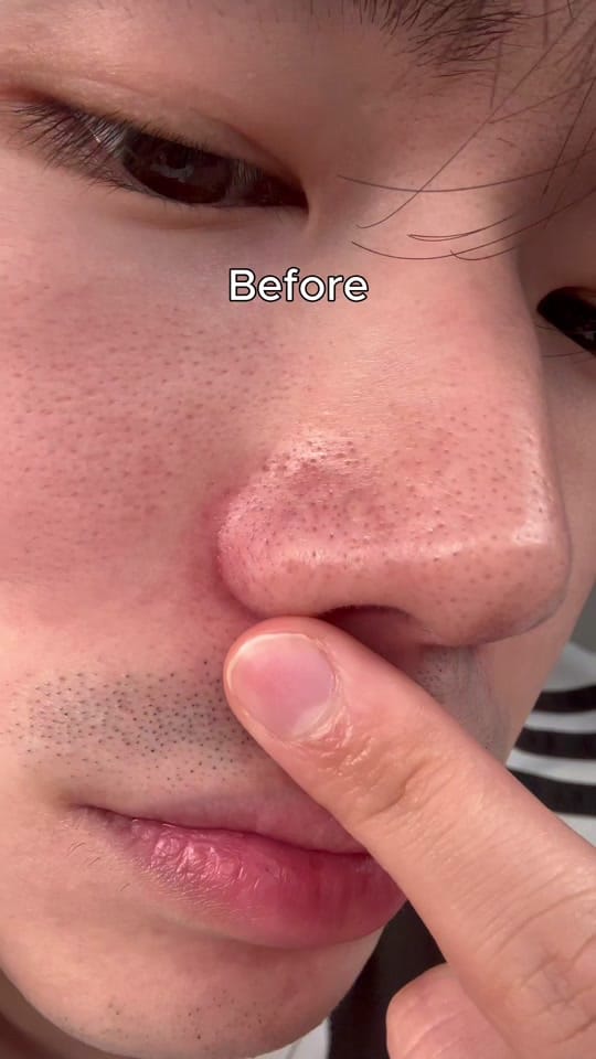 Post 10 by dongzik.skin on TikTok (video)