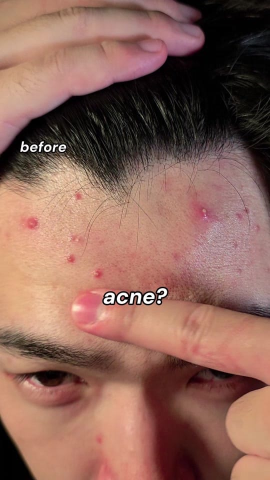 Post 3 by dongzik.skin on TikTok (video)