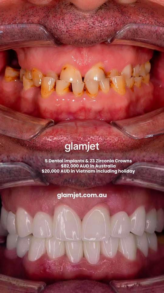 Post 4 by glamjet.com.au on TikTok (video)