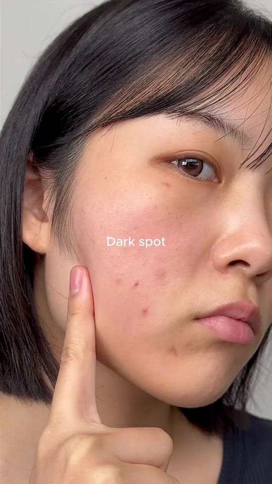 Post 2 by malangcutiee 🫧 I Kbeauty on TikTok (video)